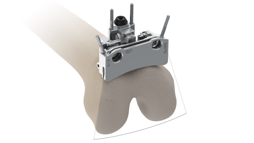 Cutting Block on Femur